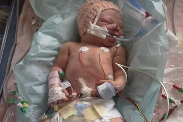 בסכנת חיים: תינוק שנולד בשבוע 30 ועדיין אין לו שם בסכנת חיים: תינוק שנולד בשבוע 30 ועדיין אין לו שם