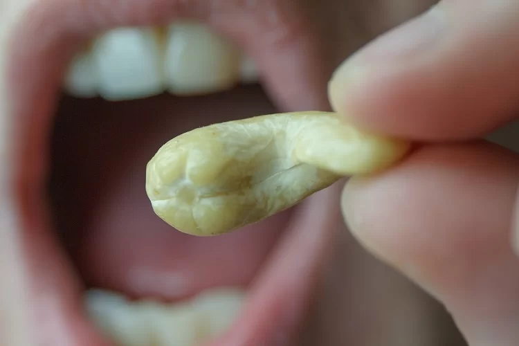 הלם: אוכלים קשיו? מה מסתתר בקשיו? "חי נושם ובועט"