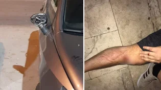 יהודי הוכה נמרצות ע"י ערבי במעלה אדומים. המשטרה: "לא לאומני"