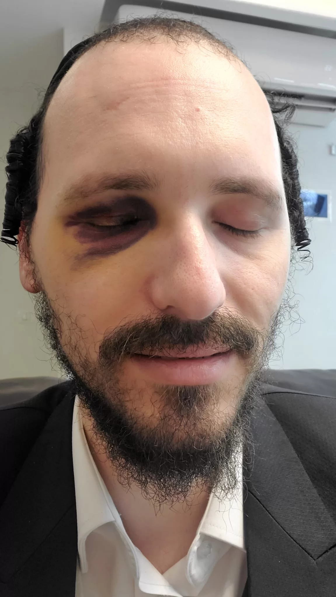 תוקפי האברך הסגירו את עצמם אבל המשטרה סגרה את התיק תוקפי האברך הסגירו את עצמם אבל המשטרה סגרה את התיק