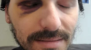 תוקפי האברך הסגירו את עצמם אבל המשטרה סגרה את התיק