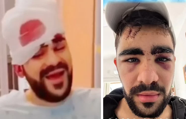 מתאונות כאלה בדרך כלל לא יוצאים בחיים: "הרכב עלה בלהבות"