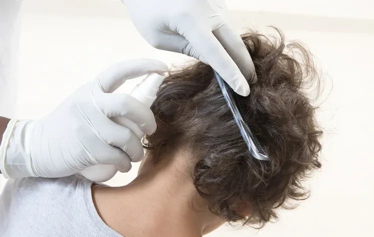 האם מותר להרוג כינים בשבת?