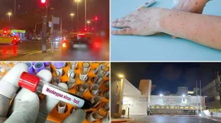 התפשטות בעולם: מחלת אבעבועות הקוף ועם מוטציות חדשות