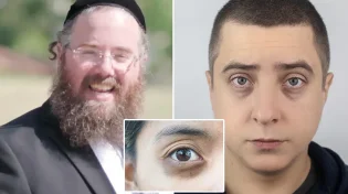 איך להעלים עיגולים שחורים מתחת לעיניים? הרב שמשון פוקס