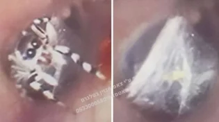 וואו: אפילו הרופא לא האמין לתגלית המחרידה באוזן