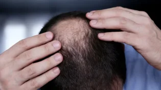 הסוף לנשירות בשיער: תרופת סבתא להצמחת שיער
