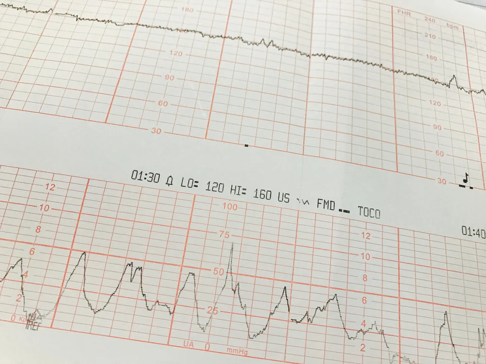 איך לגרום לעובר לזוז? תנועות עובר כמו דופק בלילה