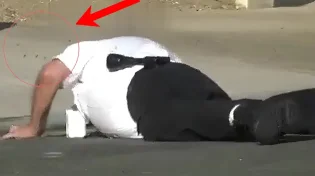 לא נעים: מתנדב המשטרה נקרא לאירוע וקיבל עשרות עקיצות - צפו: