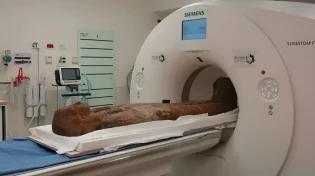 ארונות קבורה בני אלפי שניים עברו סי.טי בשערי צדק