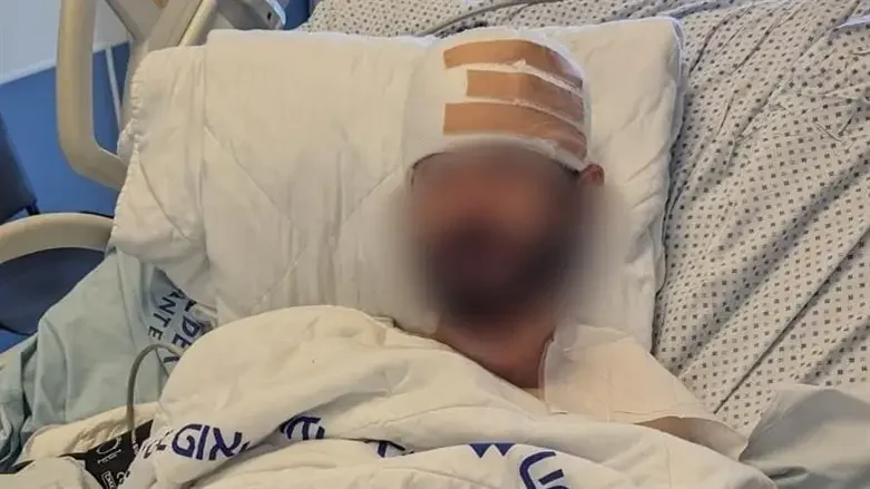 יהודי שנפצע קשה מלינץ של ערבים ופתח באש נעצר