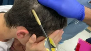 סכנת נפשות: חץ נתקע בראשו של בן 12 במהלך משחק "קליעה למטרה" 