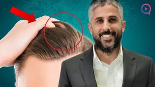הסתכלו על שיערות ראשכם ותראו דבר מדהים! הרב עידו סממה