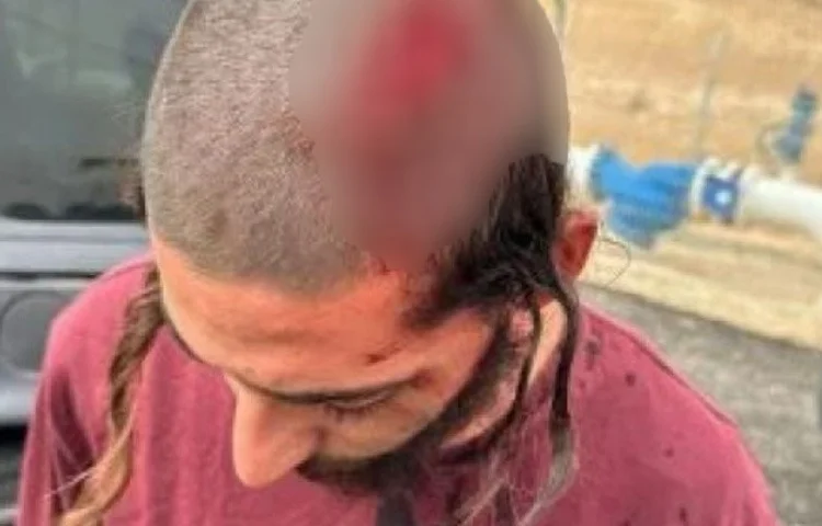 צעיר יהודי הותקף בידי פועלים ערבים במצפה יריחו. מצבו קל צעיר יהודי הותקף בידי פועלים ערבים במצפה יריחו. מצבו קל