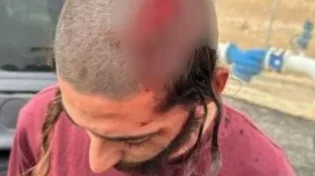 צעיר יהודי הותקף בידי פועלים ערבים במצפה יריחו. מצבו קל