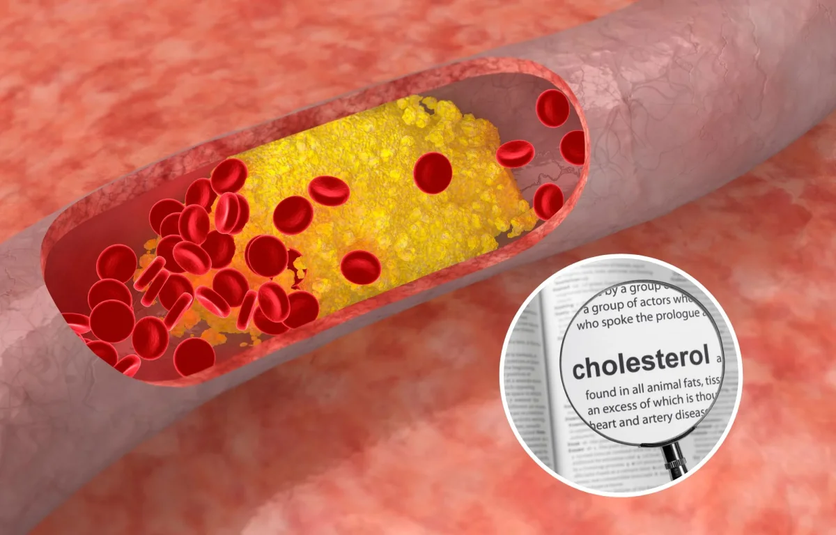 איך להעלים כולסטרול מהגוף בצורה טבעית?