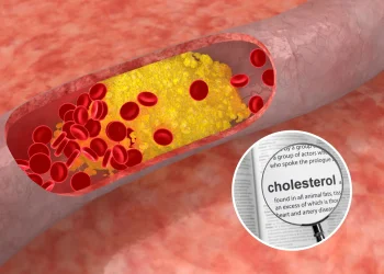 איך להעלים כולסטרול מהגוף בצורה טבעית?