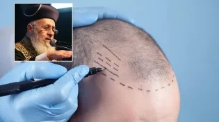 מי שעשה השתלת שיער, מניח תפילין?