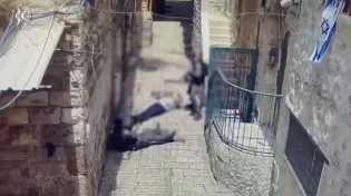 פיגוע דקירה בירושלים: שוטר נפצע באורח קל-בינוני
