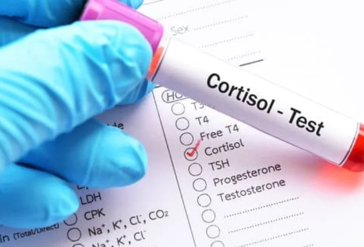 אתם לא רוצים לדעת: מה קורה לגוף כשרמת הקורטיזול עולה?