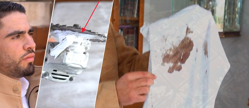 נס מטורף: "כמעט ניסרתי את הלב, הציצית הצילה אותי" נס מטורף: "כמעט ניסרתי את הלב, הציצית הצילה אותי"