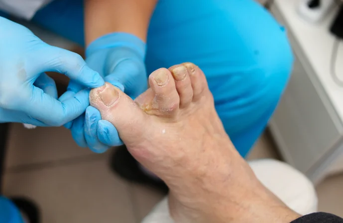 זה הטיפול הנכון בכפות הרגליים, שימנע זיהומים ופטריות זה הטיפול הנכון בכפות הרגליים, שימנע זיהומים ופטריות