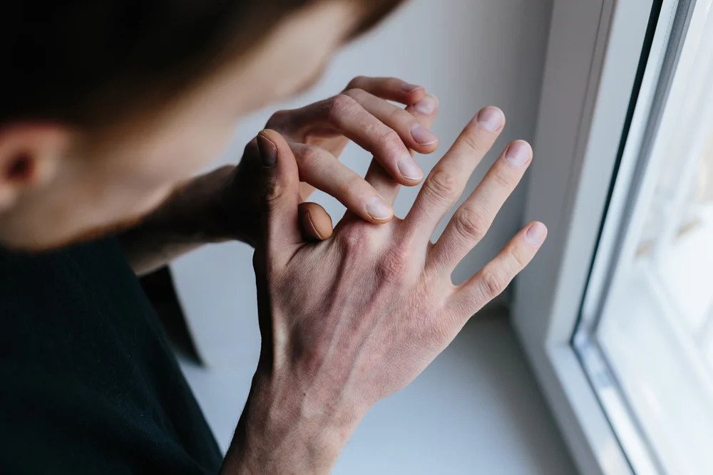 5 סימנים לכך שהעור שלכם מדי יבש 5 סימנים לכך שהעור שלכם מדי יבש