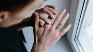 5 סימנים לכך שהעור שלכם מדי יבש