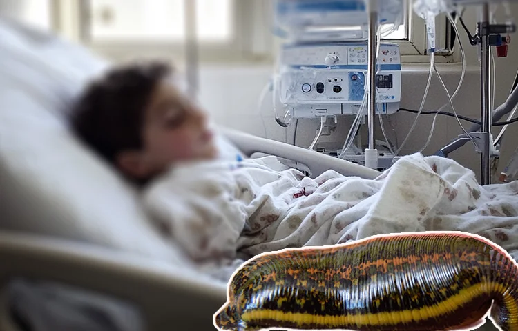 הורים נבהלו: בן 7 השתעל בלי הפסקה – ואז עלוקה חיה יצאה לו מהפה!