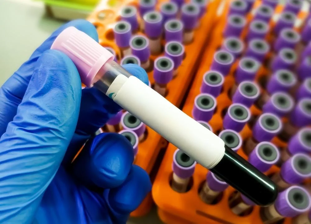 הצלת חיים בניידת: בדיקת דם מהירה תוכל למנוע נזק מוחי בלתי הפיך