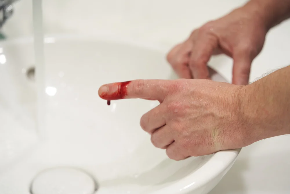 נחתך באצבע – והתעורר בלי ידיים ורגליים: "החיים שלי נגמרו ברגע אחד" נחתך באצבע – והתעורר בלי ידיים ורגליים: "החיים שלי נגמרו ברגע אחד"