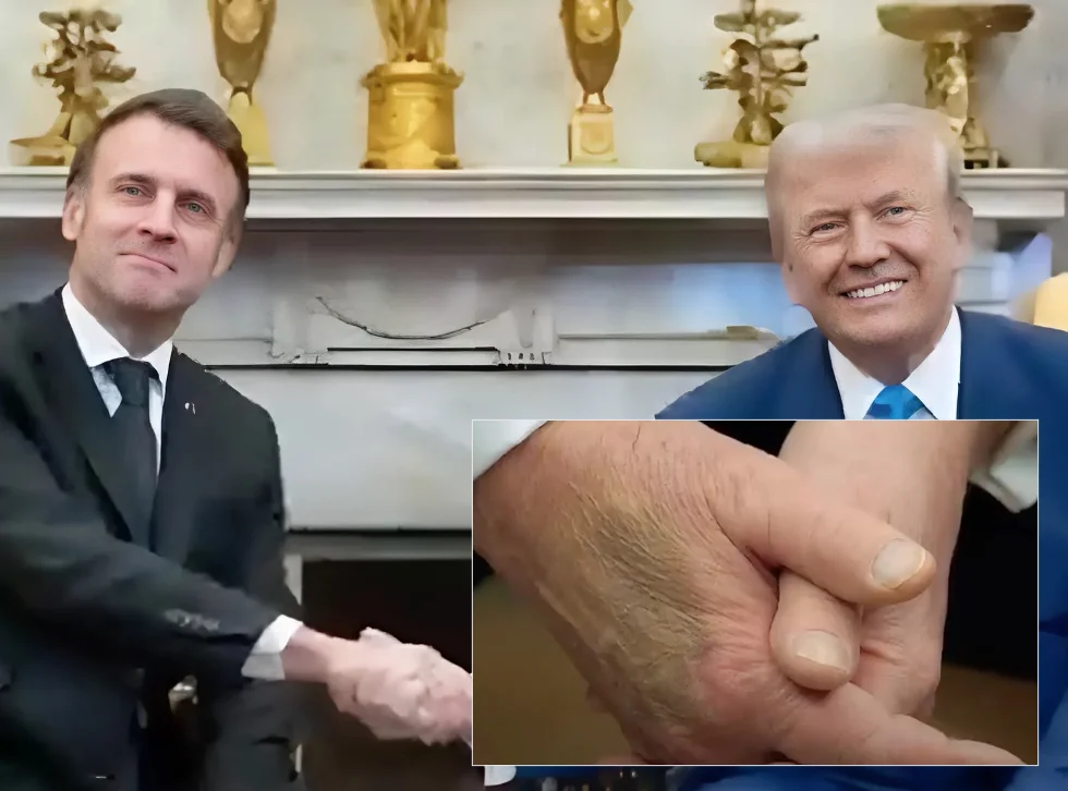 חשש בריאותי לנשיא טראמפ: כתמים מסתוריים על ידו מעוררים תהיות חשש בריאותי לנשיא טראמפ: כתמים מסתוריים על ידו מעוררים תהיות