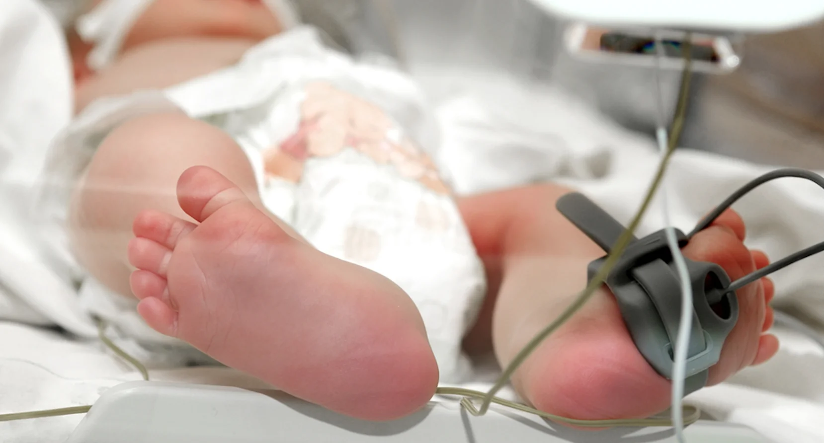 ההורים טסו חצי עולם – כדי להציל את פניו של בנם התינוק ההורים טסו חצי עולם – כדי להציל את פניו של בנם התינוק