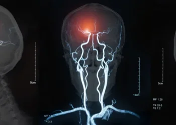 "רצף של טעויות אבחנתיות &ndash; ואירוע מוחי שניתן היה למנוע": פיצוי של יותר מ-3 מיליון ש"ח לאישה שנותרה סיעודית