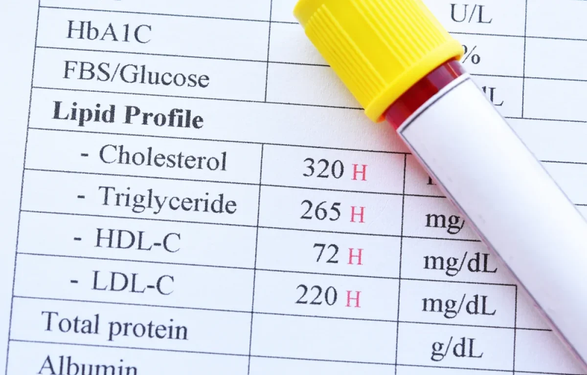 בדיקת דם אחת שיכולה להציל חיים: הכול על כולסטרול גבוה