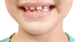 ה-FDA מפסיק את הפלואוריד לילדים - צעד בריאותי או טעות הרת גורל?