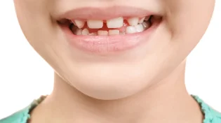 ה-FDA מפסיק את הפלואוריד לילדים - צעד בריאותי או טעות הרת גורל?