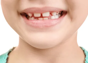 ה-FDA מפסיק את הפלואוריד לילדים &ndash; צעד בריאותי או טעות הרת גורל?