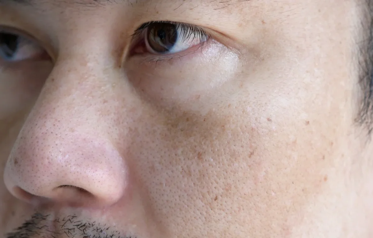 כתמי גיל? תיפרדו מהם עם מה שיש לכם במטבח