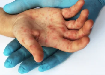 "ונשמרתם לנפשותיכם": מחלה אחת, חמש מיטות טיפול נמרץ &ndash; ואינספור סימני שאלה