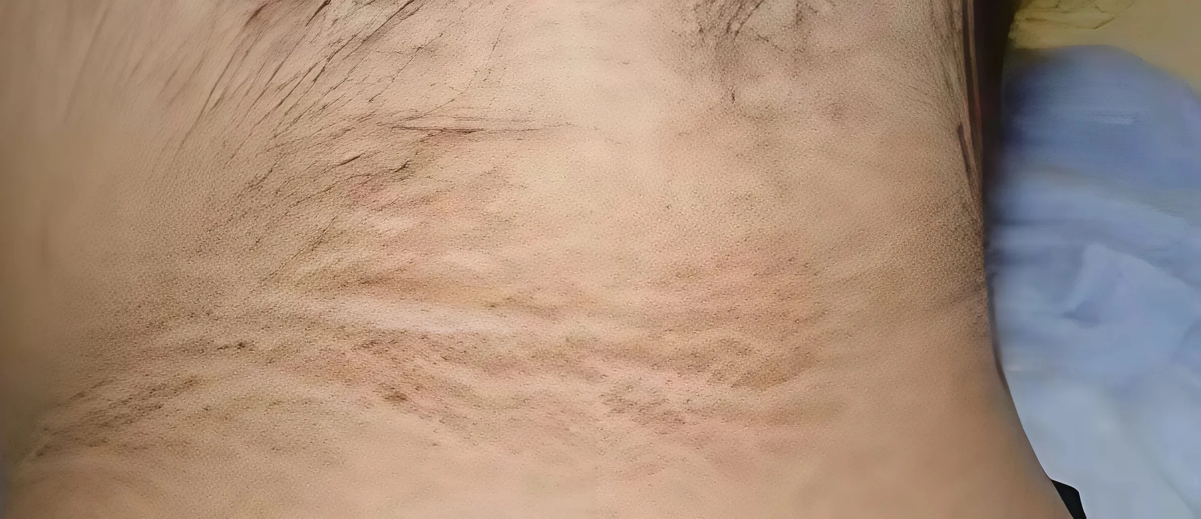 היא חשבה שזה לכלוך – ואז גילתה שמדובר בסכנת חיים היא חשבה שזה לכלוך – ואז גילתה שמדובר בסכנת חיים