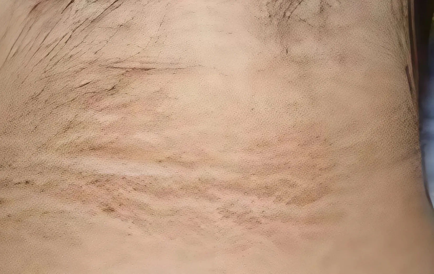 היא חשבה שזה לכלוך – ואז גילתה שמדובר בסכנת חיים