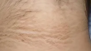 היא חשבה שזה לכלוך - ואז גילתה שמדובר בסכנת חיים