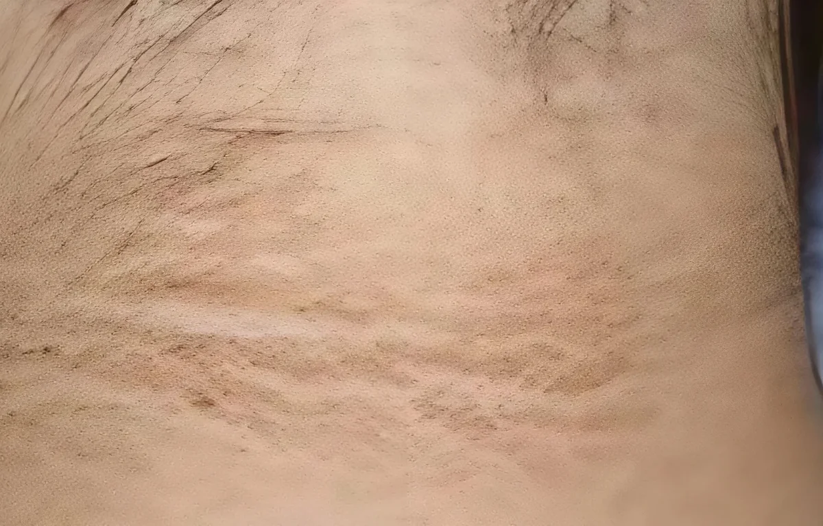 היא חשבה שזה לכלוך – ואז גילתה שמדובר בסכנת חיים היא חשבה שזה לכלוך – ואז גילתה שמדובר בסכנת חיים