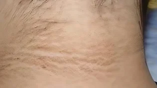 היא חשבה שזה לכלוך - ואז גילתה שמדובר בסכנת חיים