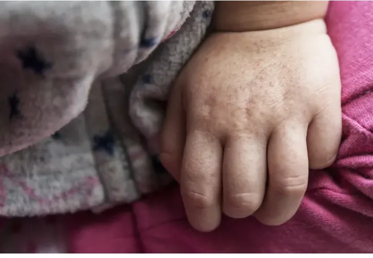 פריחה מוזרה על הילד? תירגעו – זו כנראה דווקא החדשות הטובות