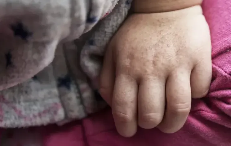 פריחה מוזרה על הילד? תירגעו – זו כנראה דווקא החדשות הטובות פריחה מוזרה על הילד? תירגעו – זו כנראה דווקא החדשות הטובות