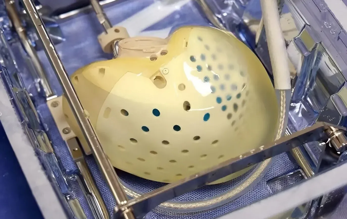 "הוצאנו את הלב – והכנסנו עתיד": ניתוח נדיר בשיבא פותח עידן חדש לחולי לב בישראל