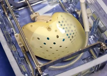 "הוצאנו את הלב &ndash; והכנסנו עתיד": ניתוח נדיר בשיבא פותח עידן חדש לחולי לב בישראל