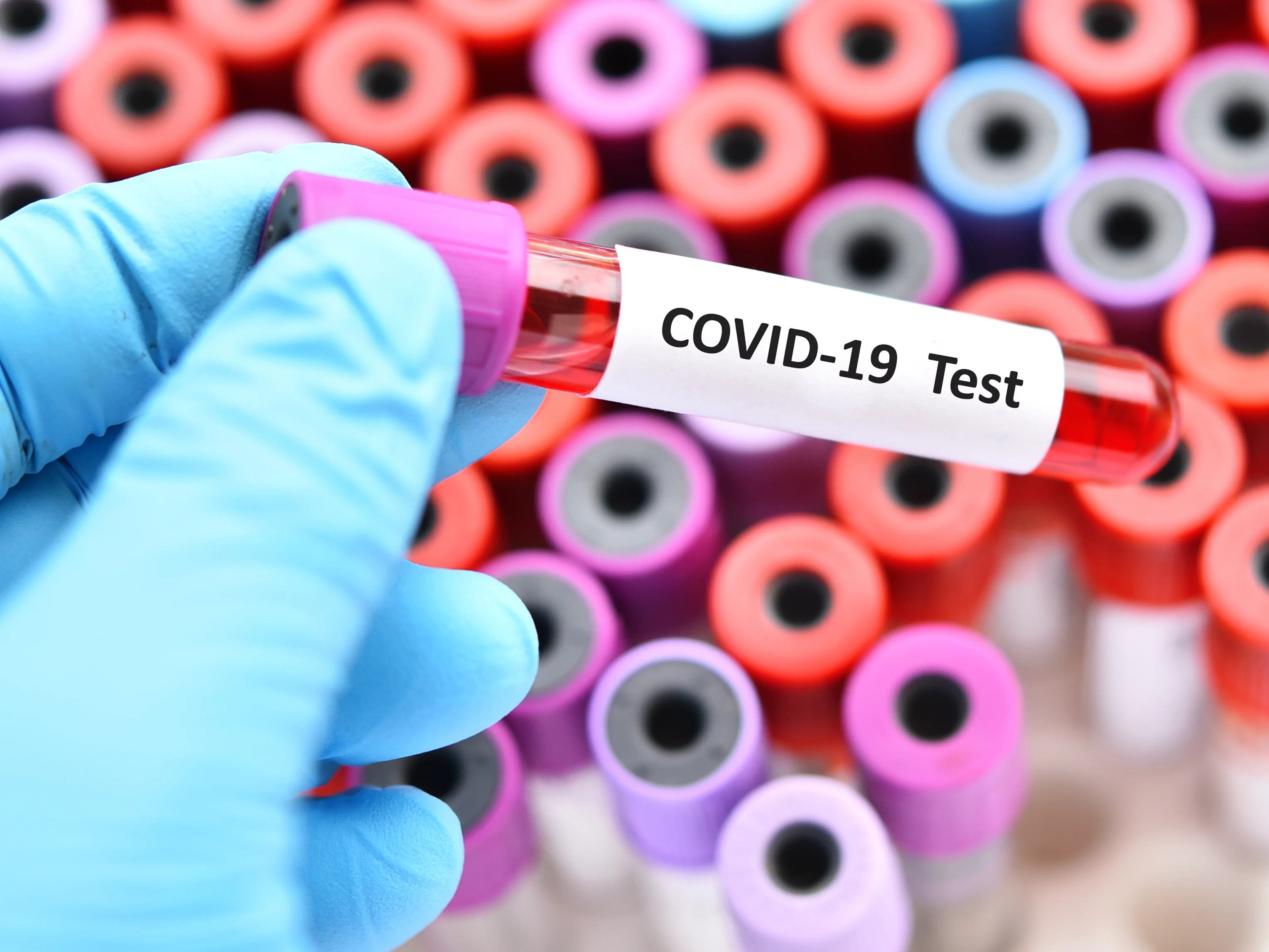 "התחסנות בירידה – וזן חדש בדרך": ישראל שוב עוצמת עיניים מול מגפת הקורונה